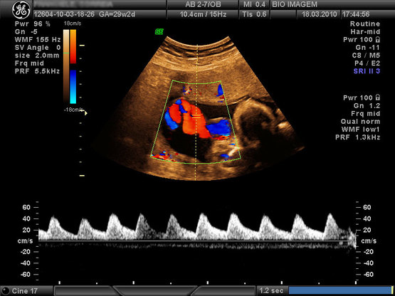 Ultrassonografia Com Doppler Omni Diagnóstico 